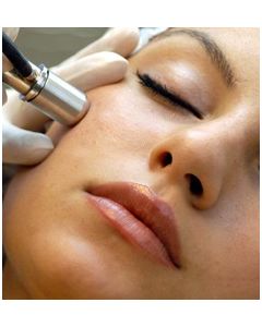 Microdermabrasie met of zonder ADAP registratie Microdermabrasie met of zonder ADAP registratie
