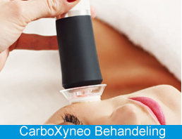 CarboXyneo Behandeling