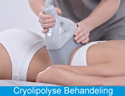 Cryolipolyse Behandeling