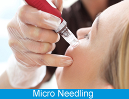 Micro Needling